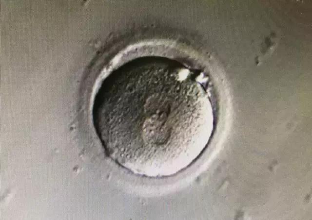 太神奇！生殖医学博士揭秘试管婴儿全过程！