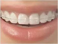 俗话说牙缝大会漏财,两边牙缝大漏财还是进财