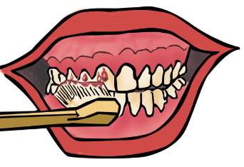 孕妇牙疼的时候可以拔牙吗,孕期牙疼能上医院拔牙吗