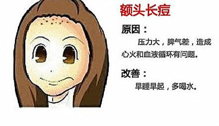 12岁额头长痘是什么原因怎么治,额头和眉间长痘的原因及调理方法