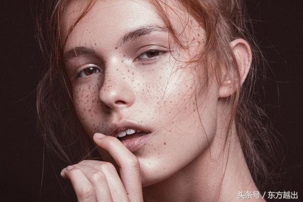 茶油祛斑最快最有效的方法,男士祛斑除黑色素最有效方法