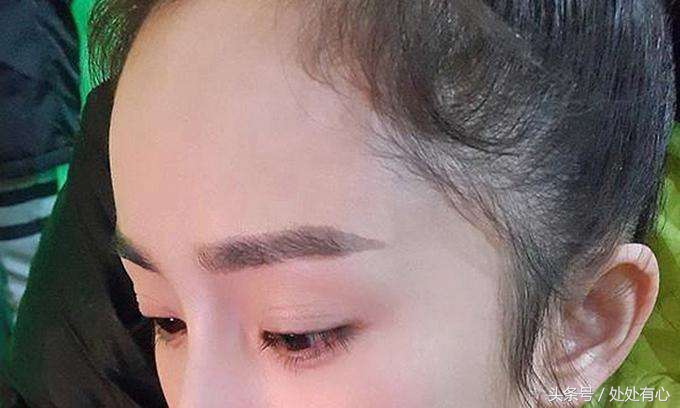 产后脱发生发密发的最好方法,秦舒培和刘雯发际线