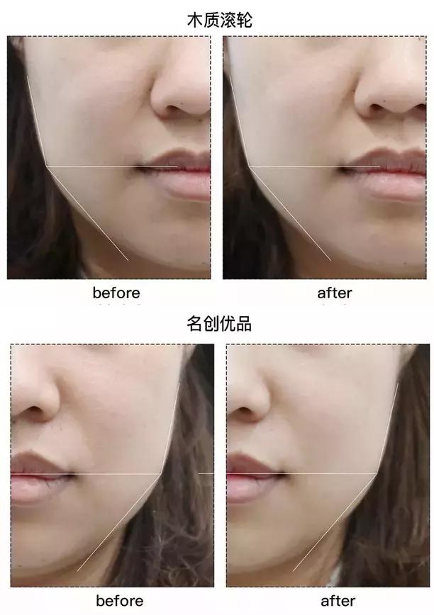 refacaratray瘦脸滚轮美容仪,refa进口滚轮瘦脸仪