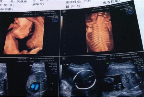 做四维看到胎儿最想说的话,做四维医生说宝宝发育得很好