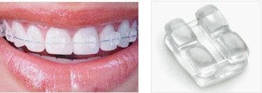 不用牙套能不能把龅牙搞回去,少了一颗牙齿戴牙套矫正全过程