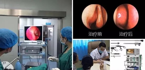 一个鼻窦长了囊肿是什么症状,做什么检查可以发现鼻部的囊肿