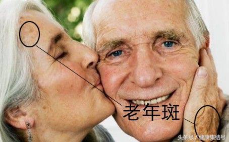 色斑的预防和治疗快速去除色斑,色斑的原因及治疗方法