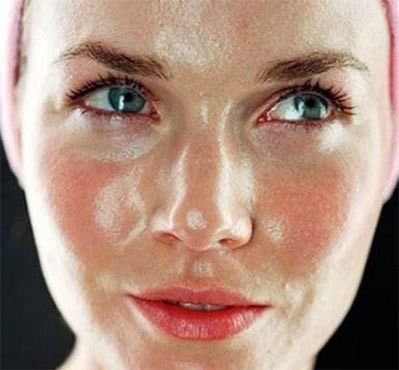 鼻翼如何祛痘,鼻头祛痘小妙招学生党不花钱