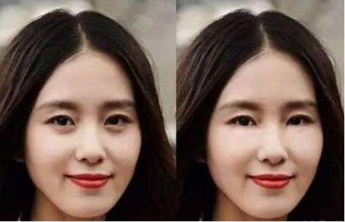赵丽颖脸前后对比照片,赵丽颖整眼睛前后对比照片
