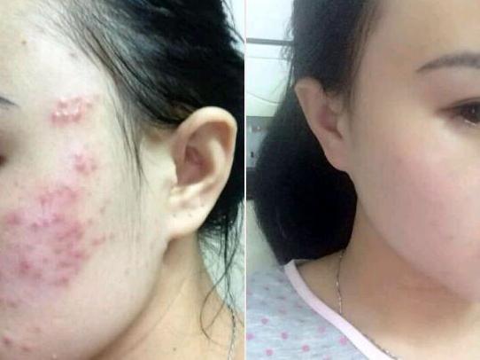 有没有不对皮肤导致负担的彩妆,哪个牌子的彩妆对脸没有伤害