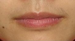 唇毛应该怎么刮,刮了唇毛怎么处理