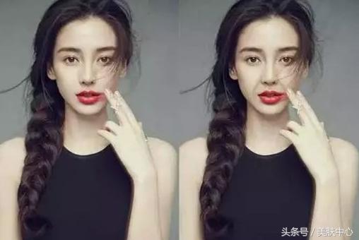 25岁比同龄人还老法令纹很深,20岁法令纹很深是什么原因