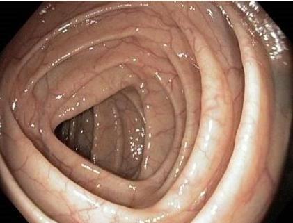 宝宝缺锌怎么办最简单方法,宝宝缺锌要如何食疗