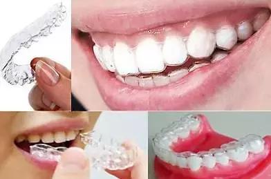 隐形牙套和钢牙套各有什么优缺点,儿童整牙是隐形牙套好还是钢牙好