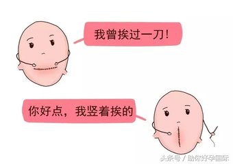 瘢痕子宫怀孕后要注意些什么,瘢痕子宫再怀孕需要注意什么