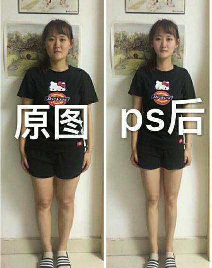 ps和整容术哪个好,ps整容收费