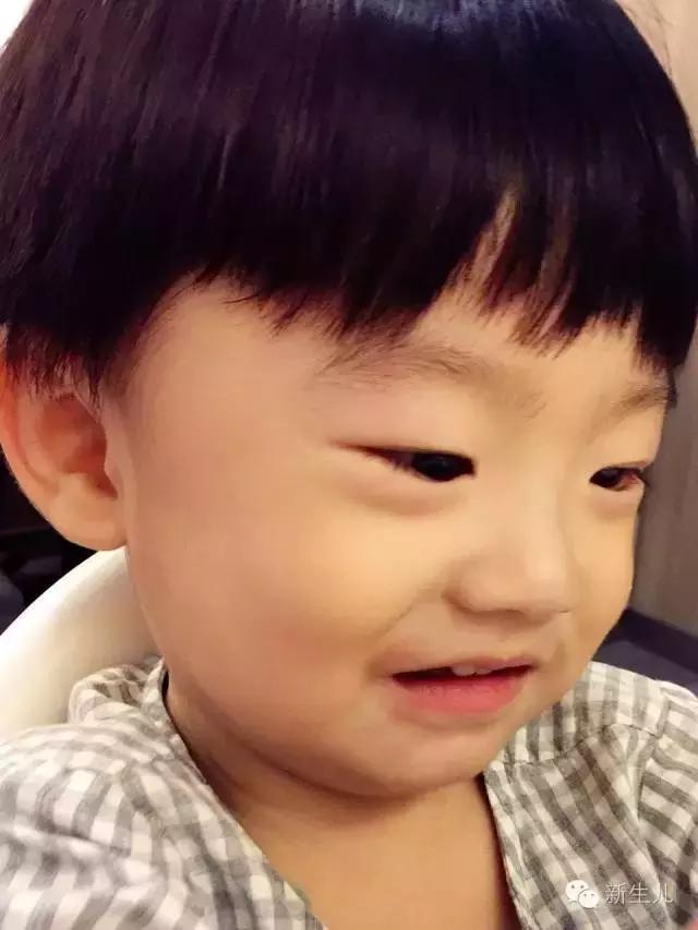 新生儿：婴儿皮肤起红疹？教你如何护理宝宝娇嫩的皮肤