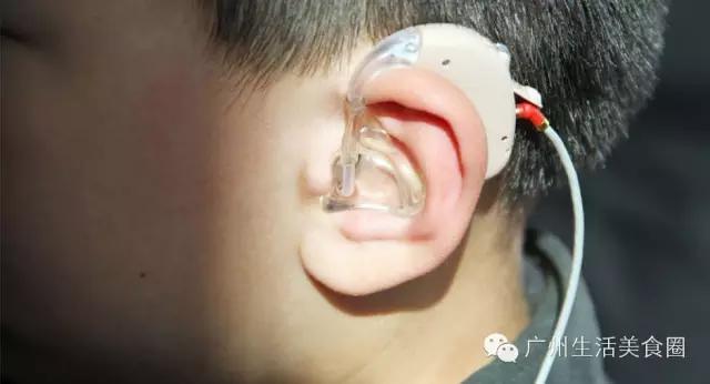 广州一次性医疗补助金谁来给,广州大额医疗费用补助每月扣多少