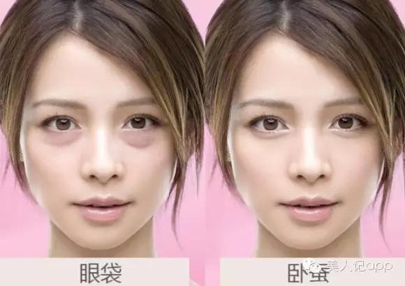 怎么区分眼袋黑眼圈泪沟卧蚕,卧蚕眼袋泪沟黑眼圈