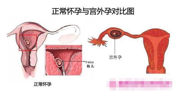 宫外孕测试纸能测出怀孕了嘛,一张验孕纸可以验两次吗