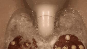 拔火罐能祛湿体内的湿气吗,祛除湿气拔火罐方法