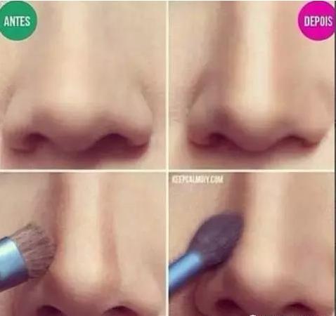 一张图让你全面了解鼻综合整形,鼻综合整形后鼻子一般多久消肿