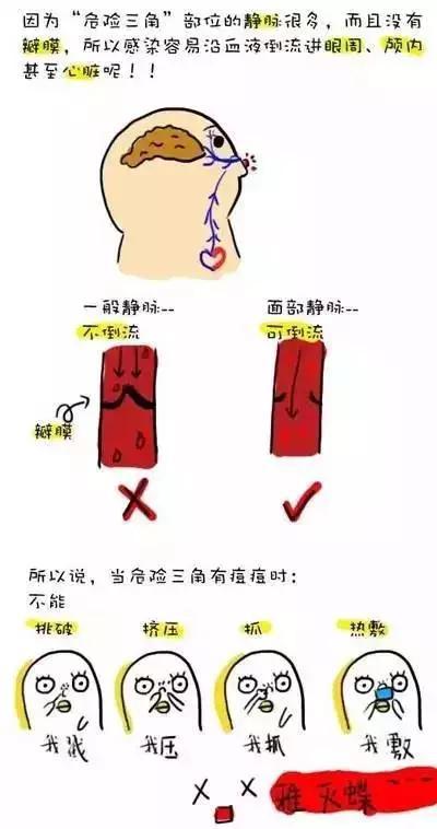 如何挤痘痘才是正确的方法,手把手教你挤痘痘