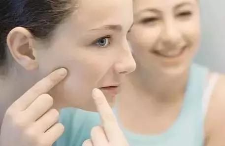 如何挤痘痘才是正确的方法,手把手教你挤痘痘