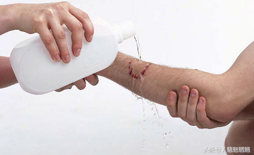 狂犬病传染知识图片,狂犬病最权威知识