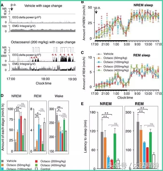 工作压力太大睡不着觉怎么办,压力大情绪低落睡不着觉手抖