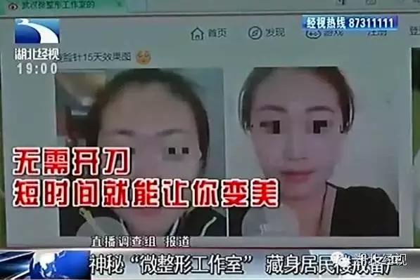 惊爆|深喉揭内幕：武汉所有微整形工作室都是无证经营