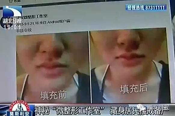 惊爆|深喉揭内幕：武汉所有微整形工作室都是无证经营