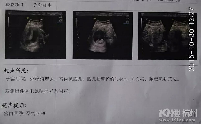 如愿生了个女宝,如愿备孕成功的记录