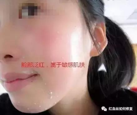 朵嘉浓晓晓敏感肌肤可以美白吗,朵嘉浓晓晓敏感肌肤能美白吗