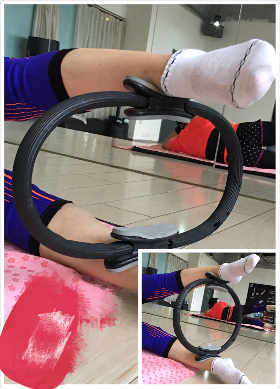 o型腿怎么矫正,O形腿的矫正方法