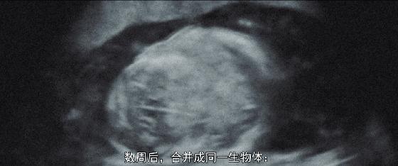 要说尺度，法国片有时比日本片更百无禁忌！