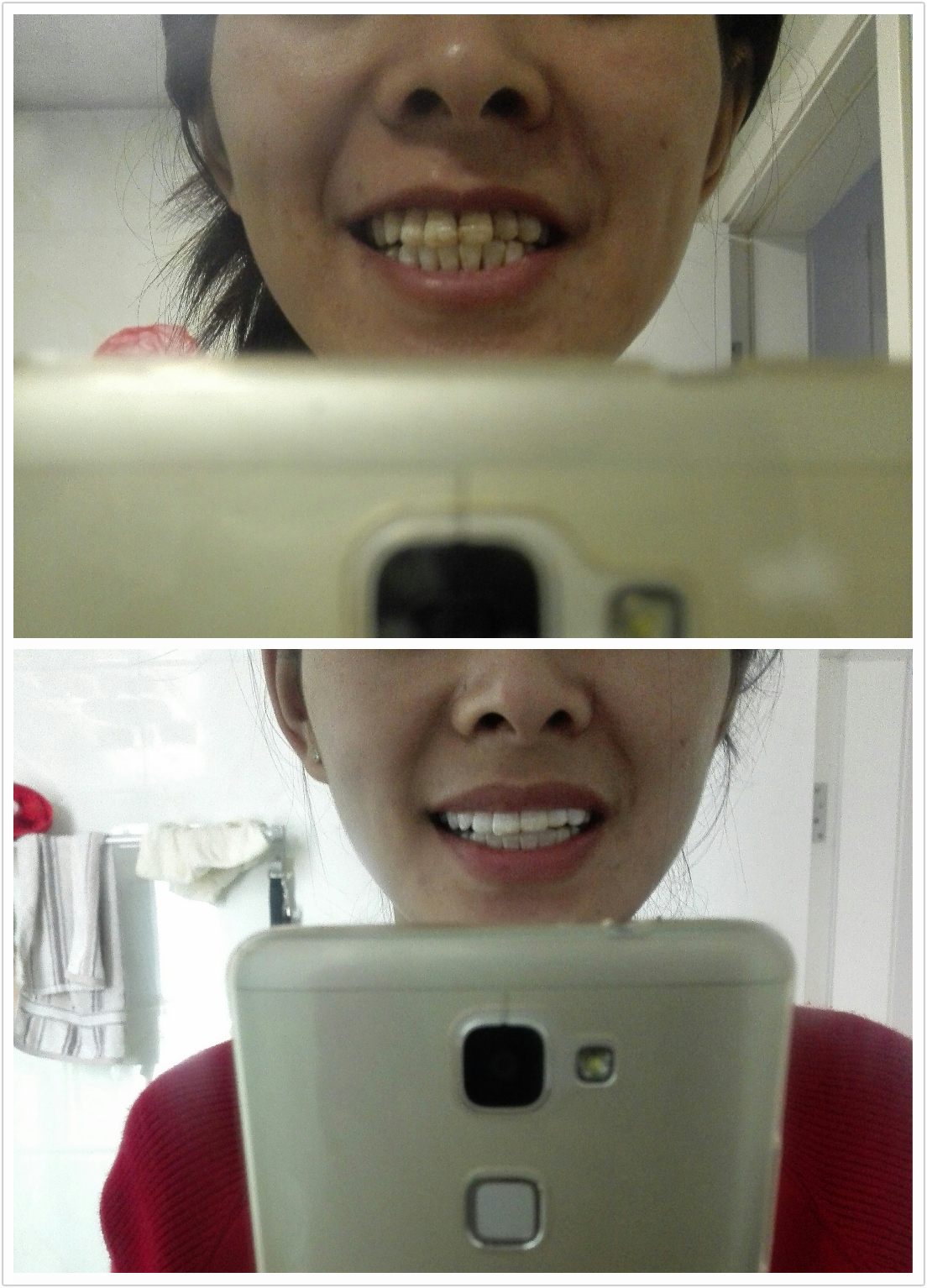 比较有效的牙齿美白方法,你需要知道的牙齿美白小窍门