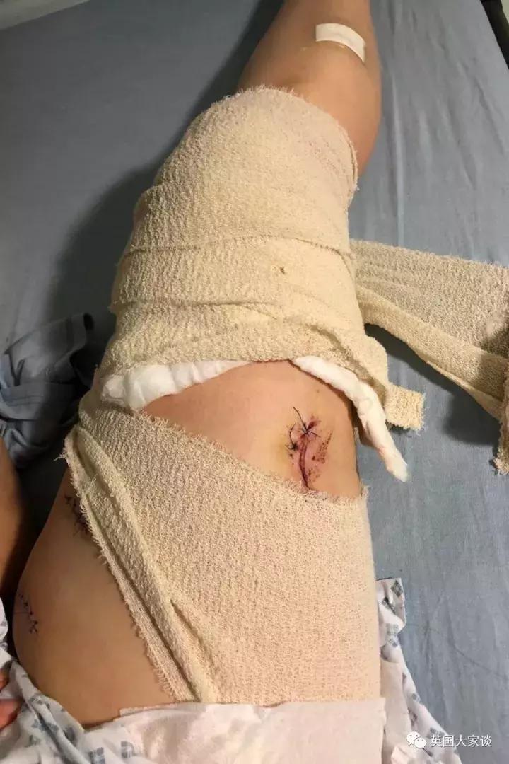 华人伦敦遭鹿攻击酿惨剧，事发地里士满公园警告：务必离鹿50米！