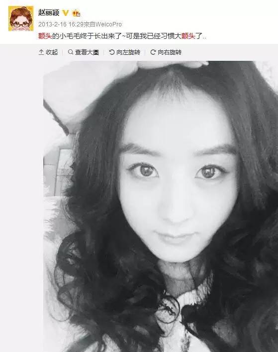 赵丽颖改变的不只是发际线和额头,发际线低额头窄赵丽颖