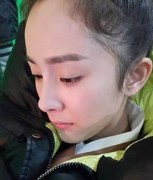 赵丽颖改变的不只是发际线和额头,发际线低额头窄赵丽颖