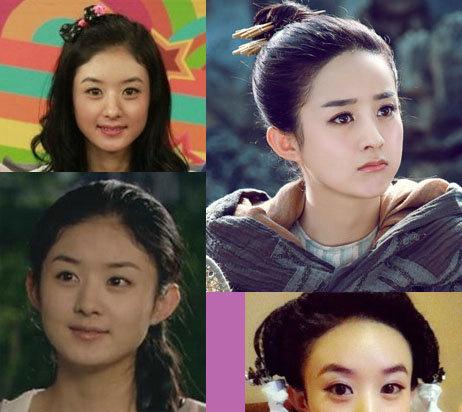 赵丽颖改变的不只是发际线和额头,发际线低额头窄赵丽颖