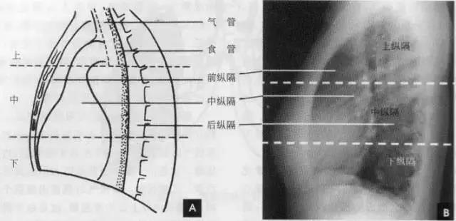 读完该文，让你学会如何看胸片