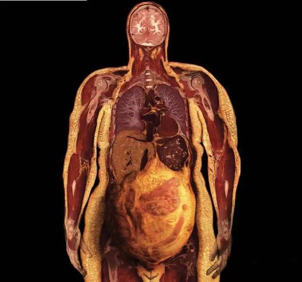 内脏脂肪怎么减下去,怎么减内脏脂肪最快最有效的方法