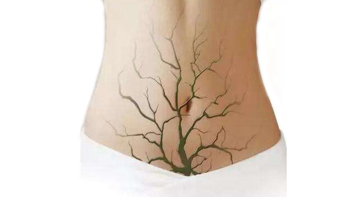 脸上和脖子上反复长痘痘什么原因,脸上反复长痘痘的原因和解决方法