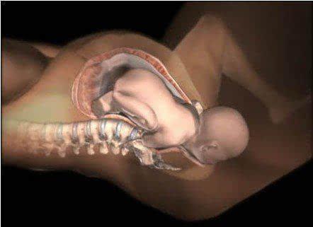 3d演示孕妇腹中胎儿,孕妇生孩子3d模拟