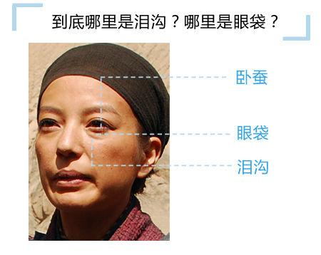 卧蚕眼袋泪沟傻傻分不清楚,卧蚕和眼袋泪沟有什么区别