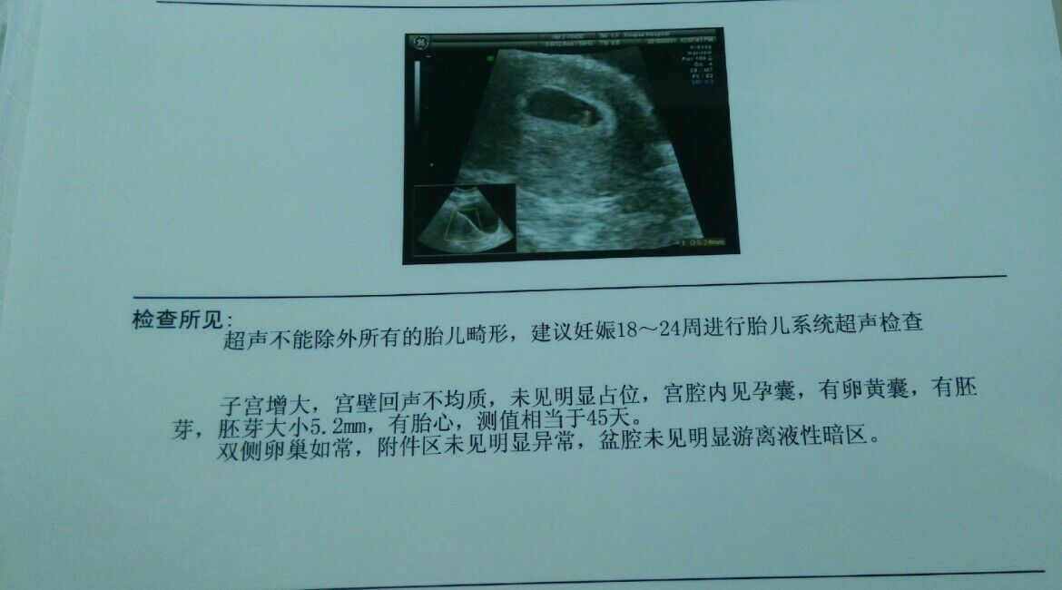 备孕各种原因处处受阻,备孕很容易吃出顺畅的备孕之路