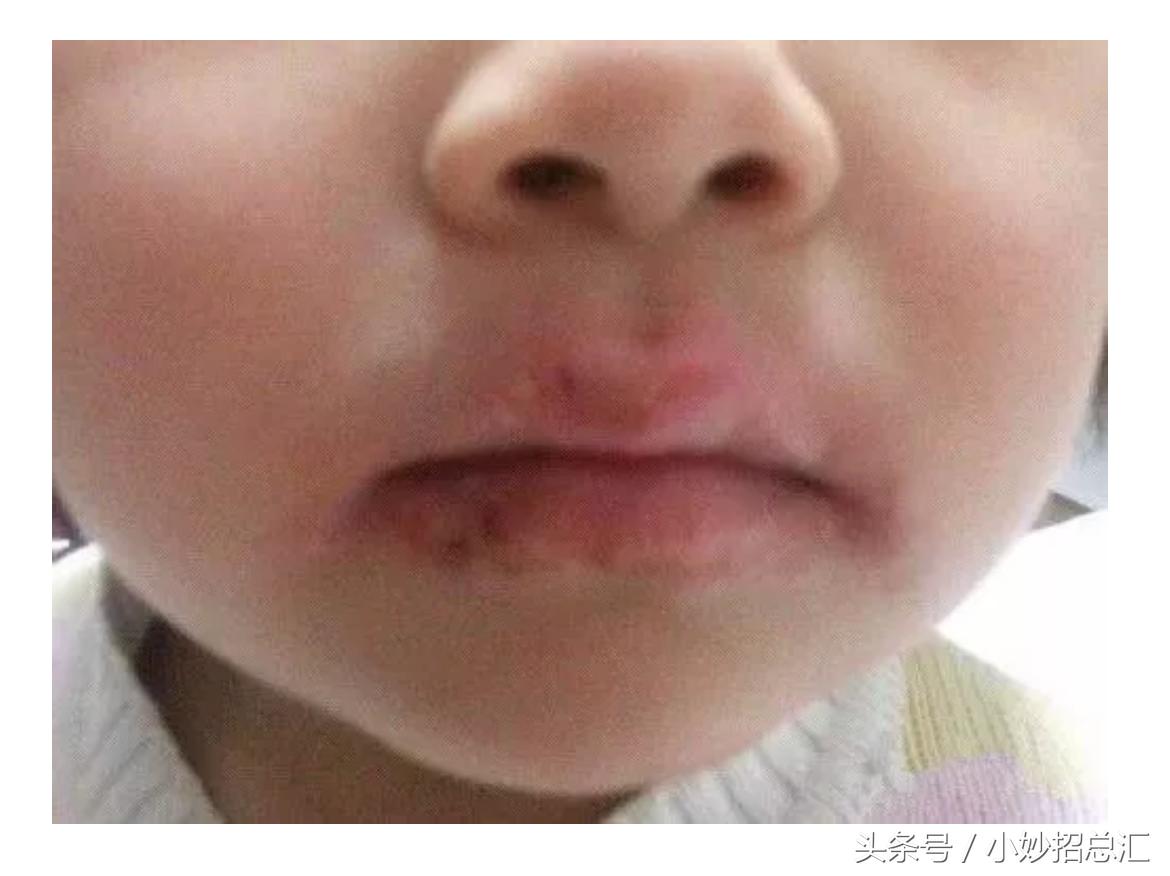 秋冬唇怎么护理,换季唇的正确护理方法