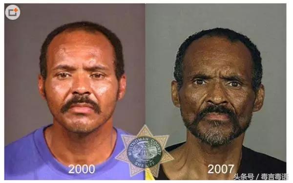 吸毒前后的变化对比,吸毒真的会毁容吗