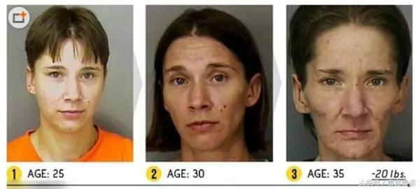 吸毒前后的变化对比,吸毒真的会毁容吗